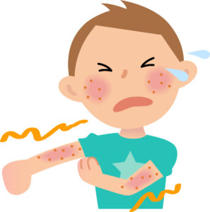 金沢みどり接骨院のアトピーの説明